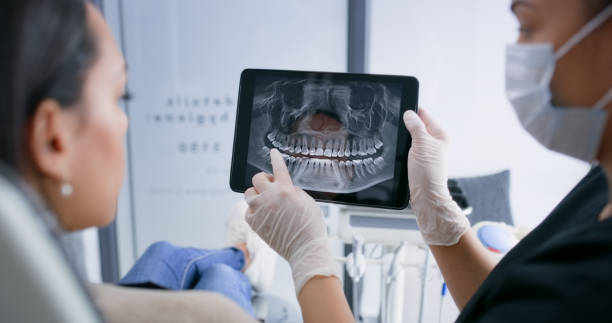 Licensed Root Canal Treatment service in North Fair Oaks, CA - Smile Center Dentistry